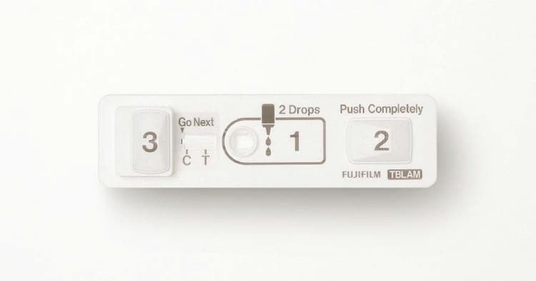 グッドデザイン大賞は富士フイルム「結核迅速診断キット」に